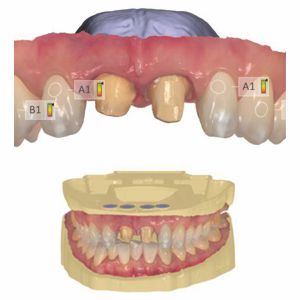 intraoral scabdaten